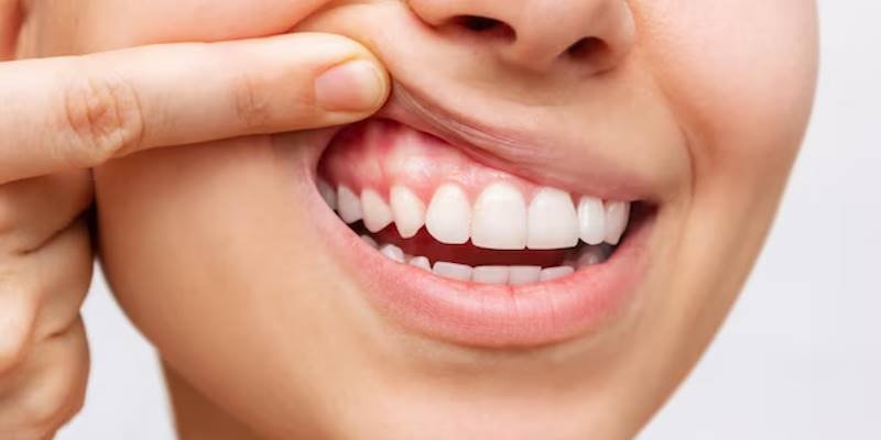 HOME APLICAÇÕES PERIODONTIA